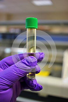 Detail of a urine test specimen in a medical laboratory