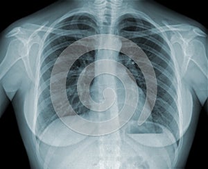 Roentgenogram img