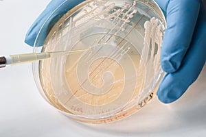 Detail of yeast inoculation performed by scientist