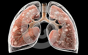 Detailed anatomical illustration of human lungs displaying bronchial structure and respiratory function in