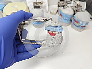 Detailed plaster models with dentures analogs in the dental laboratory