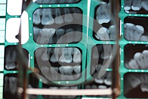 Details of teeth structure and position