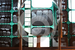 Details of teeth structure and position