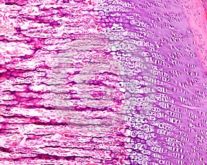 Developing bone. Epiphyseal growth plate photo