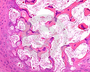 Developing bone. Epiphyseal ossification