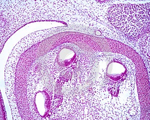 Developing cochlea