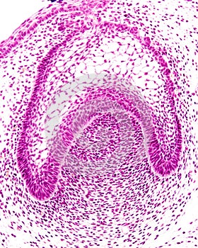 Developing tooth. Bell stage
