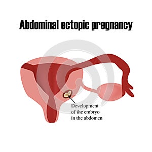 Development of the embryo in the abdomen.