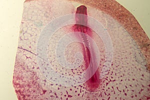 Development of the embryo chicken.