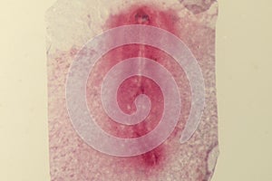 Development of the embryo chicken.