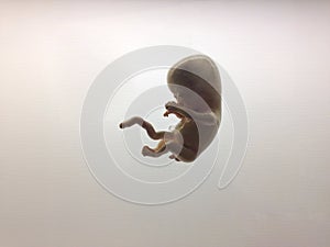 Development of human embryo