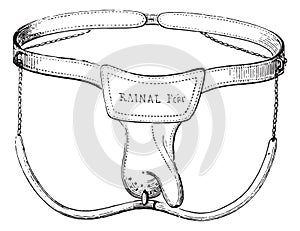 Device against masturbation in boys, vintage engraving