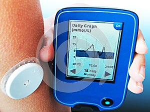 Device for continuous glucose monitoring â€“ CGM. White sensor on arm. Daily graph on screen.