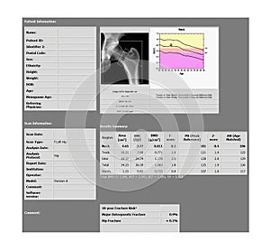DEXA densitometry report of lumbar hip scan.