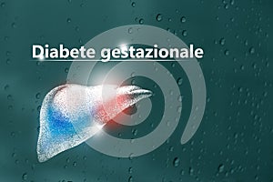 Diabete gestazionale sintomi, la lista di controllo - Spazio vuoto note carte photo