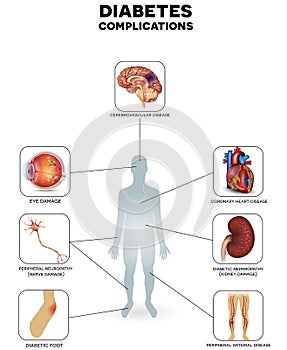 Diabetes complications