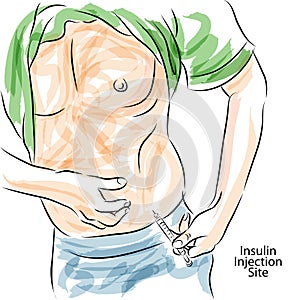 Diabetes Insulin Injection Site