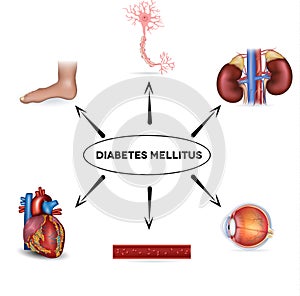 Diabetes mellitus