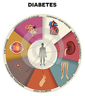 Diabetes mellitus info graphic