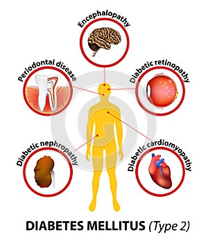 Diabetes mellitus. long-term complications