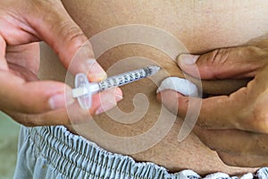 Diabetes patient gets an insulin injection in abdomen area,selective focus.