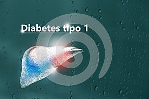 Diabetes tipo 1 - DiagnÃÂ³stico y tratamiento, lista de comprobaciÃÂ³n mÃÂ©dica. Fondo texturizado y espacio de copia vacÃÂ­o para photo