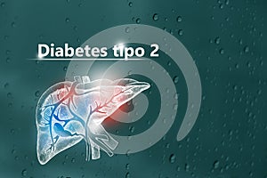 Diabetes tipo 2 - DiagnÃÂ³stico y tratamiento, lista de comprobaciÃÂ³n mÃÂ©dica. Fondo texturizado y espacio de copia vacÃÂ­o para photo