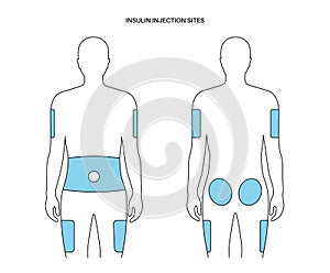 Insulin injection sites