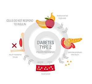 Diabetes type 2 concept in flat style, vector