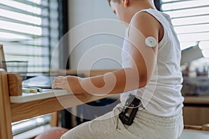 The diabetic boy doing homework, while wearing a continuous glucose monitoring sensor on his arm.