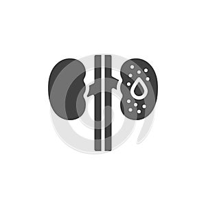 Diabetic kidney disease vector icon photo