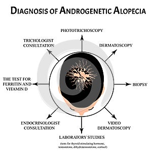 Diagnosis of alopecia. Bald spot, baldness, Alopecia mesotherapy. Infographics. Vector illustration on isolated