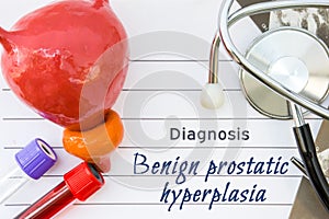 Diagnosis of Benign Prostatic Hyperplasia. Medical concept picture of prostate hyperplasia with anatomical model of bladder with