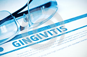 Diagnosis - Gingivitis. Medicine Concept. 3D Illustration.