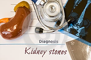 Diagnosis Kidney Stones photo. Figure of kidney lies next to inscription of diagnosis of kidney stones, ultrasound and MRI test re