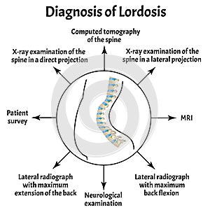 Diagnosis of lordosis. Spinal curvature, kyphosis, lordosis, scoliosis, arthrosis. Improper posture and stoop