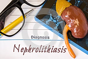 Diagnosis Nephrolithiasis photo. Figure of kidney lies next to incription of diagnosis Nephrolithiasis, MRI scan result, glasses a