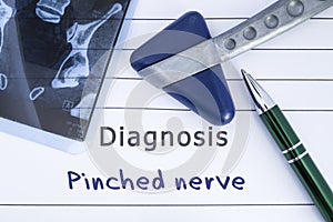 Diagnosis of Pinched Nerve. Medical health history written with diagnosis of Pinched Nerve, MRI image sacral spine and neurologica