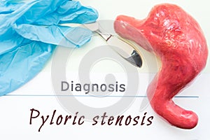 Diagnosis of Pyloric Stenosis. Figure stomach, scalpel and surgical gloves lie near title Diagnosis Pyloric Stenosis. Concept of c