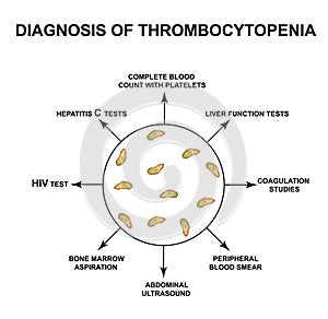 Diagnosis of thrombocytopenia. Lowering platelets in the blood. Infographics. Vector illustration on isolated background photo