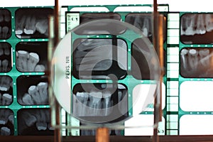 Diagnostic process in dental practice