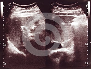 Diagnostic sonography of abdomen