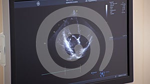 Diagnostic sonography in medical clinic, closeup view of display