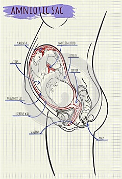 Diagram amniotik sack child