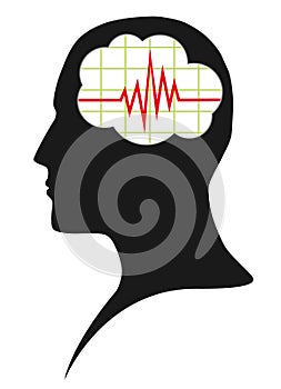 Diagram of brain activity