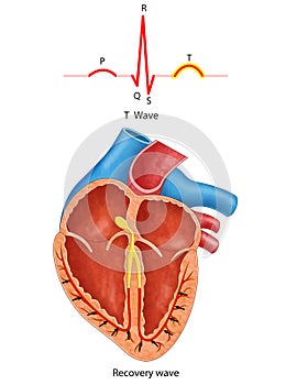 Diagram of heart T-waves