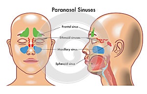 Diagram of human paranasal sinuses with annotations