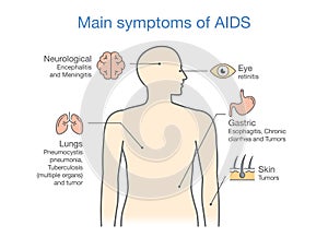 Diagram of Main symptoms of AIDS.