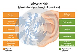 Diagram Of Physical And Psychological Symptoms Of Labyrinthitis