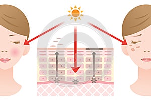 Diagram of regular skin cell turnover and slow skin cell turnover